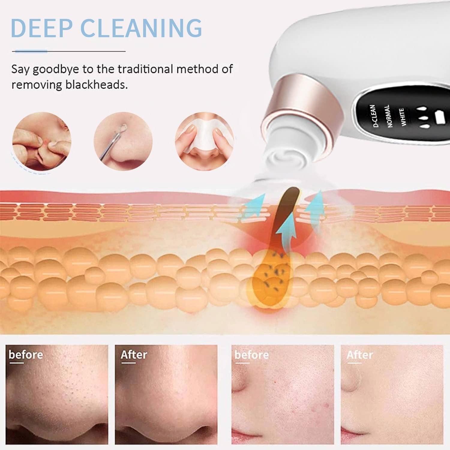 Electric Deep Cleansing Blackhead Remover