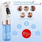 Electric Deep Cleansing Blackhead Remover